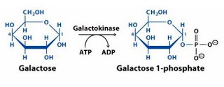 oqueegalactosemia5
