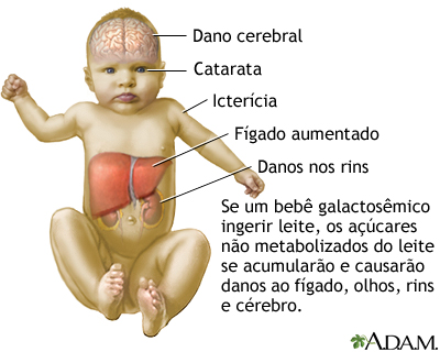 sintomas